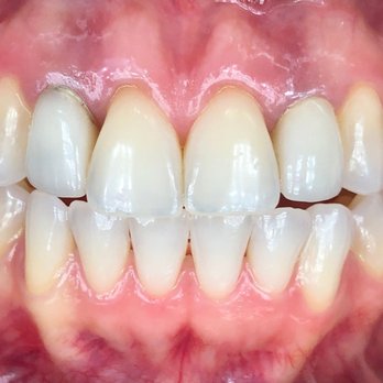 Nicole E. Kuske - Cosmetic Dentists Near Me - Lake Forest, California Nicole E. Kuske - Cosmetic Dentists Near Me - Lake Forest, California