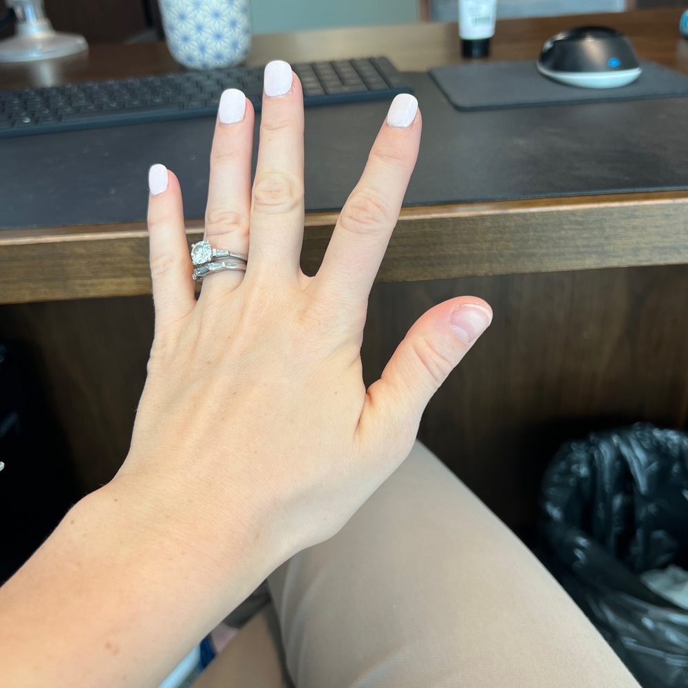 Pinklicious Nails & Spa - Broken thumb nail - Nail Salons Near Me - Wilmette, Illinois Pinklicious Nails & Spa - Broken thumb nail - Nail Salons Near Me - Wilmette, Illinois