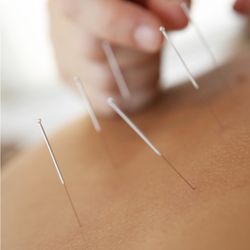 Aaaah...Wellness - Acupuncture aids in healing, pain relief, stress relief, and more.