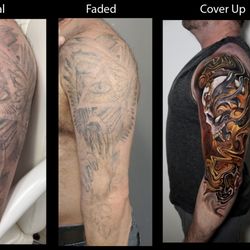 Fading Fast Laser Tattoo Removal - Tattoo Fading for a Cover Up