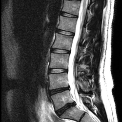 Remi Ajiboye, MD - Minimally Invasive Spine and Orthopedics