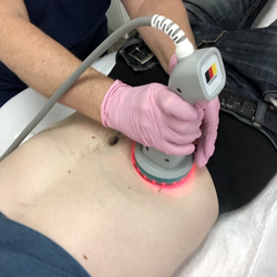 Exquisite Glamour Face & Body Sculpting - Ultrasonic Cavitation uses ultrasound waves to penetrate deep beneath the skin to target and destroy the fat cells permanently. Try today!