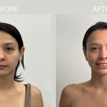 Estemica Esthetic - Photo - Estheticians Near Me - Laval, Quebec