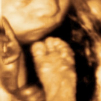 Stork Vision - Ultrasound Imaging Centers Near Me - Lawton, Oklahoma Stork Vision - Ultrasound Imaging Centers Near Me - Lawton, Oklahoma