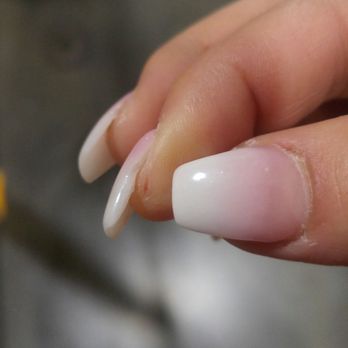 KJ Nails & Spa - Deep cut hurts so bad!! All Side of nails are not filed correctly - Skin Care Near Me - Stockton, California KJ Nails & Spa - Deep cut hurts so bad!! All Side of nails are not filed correctly - Skin Care Near Me - Stockton, California