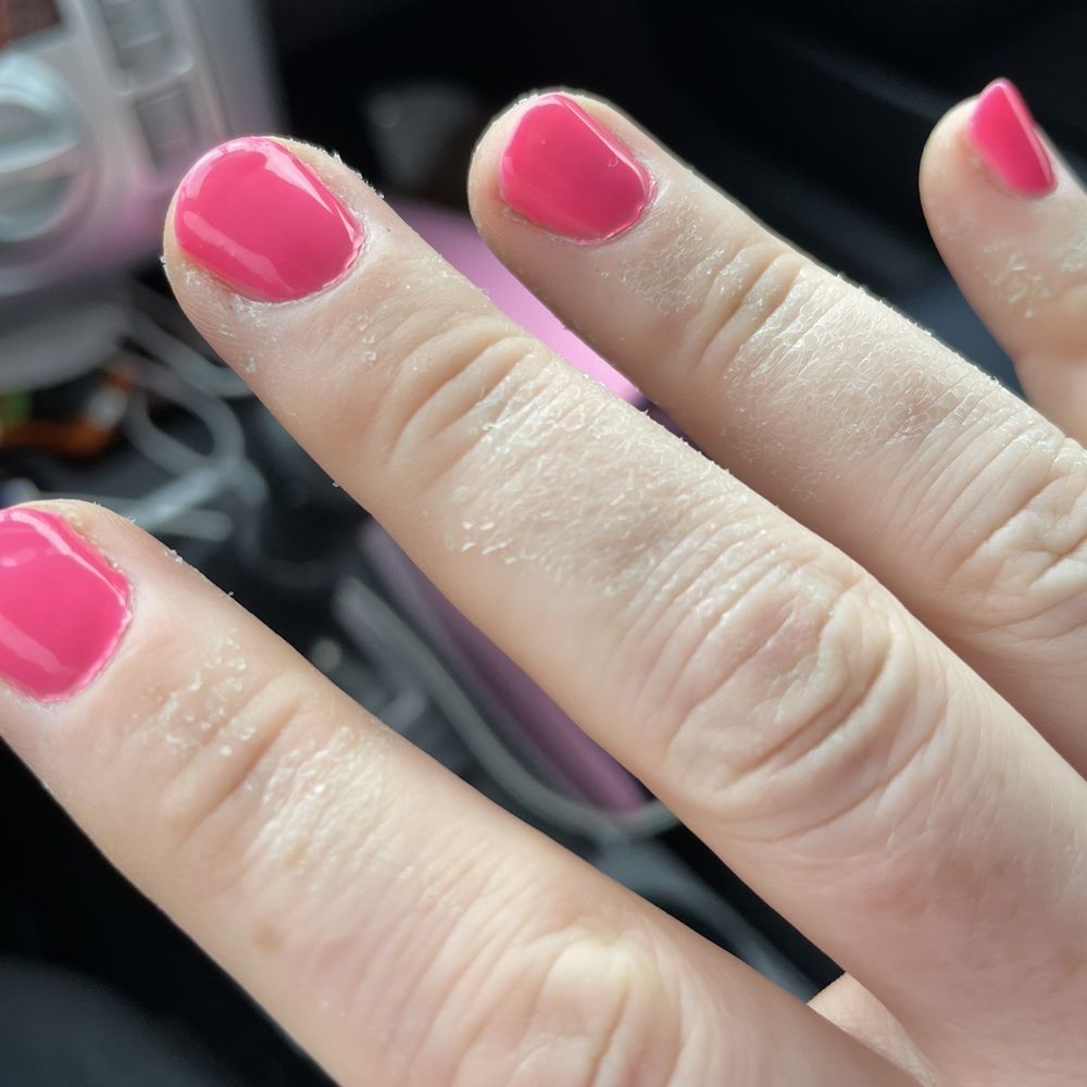 Luxury Nail Spa - Chemical burn - Waxing Near Me - Decatur, Georgia Luxury Nail Spa - Chemical burn - Waxing Near Me - Decatur, Georgia