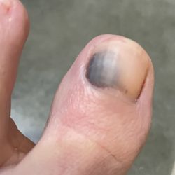 Painful Pedi! Beware!