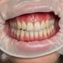 Luxo Mobile Dental