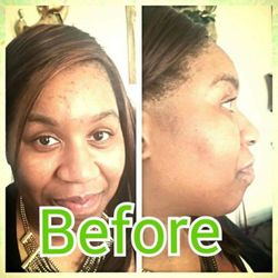 Special Touch Massage and Spa Services - This client Received a facial as she had acne prone skin she Received the Microdermabraision facial