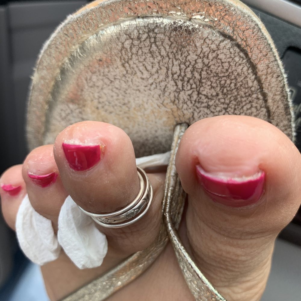 Le's Nails & Waxing - Why do my toes look like they were chewed up? So disappointed - Nail Salons Near Me - Phoenix, Arizona Le's Nails & Waxing - Why do my toes look like they were chewed up? So disappointed - Nail Salons Near Me - Phoenix, Arizona