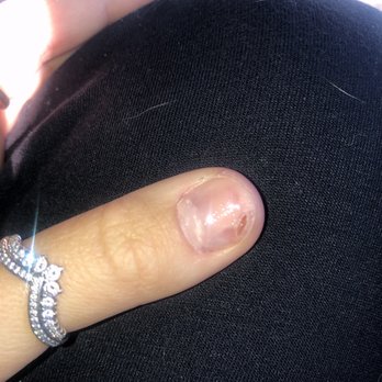 American Nails Cumming - the nail she ruined - Nail Salons Near Me - Cumming, Georgia