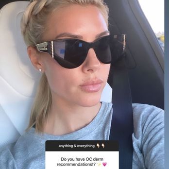 Derma Beauty Aesthetics - Skin treatment prep for Heather El Moussa before filming begins - Medical Spas Near Me - Costa Mesa , California Derma Beauty Aesthetics - Skin treatment prep for Heather El Moussa before filming begins - Medical Spas Near Me - Costa Mesa , California