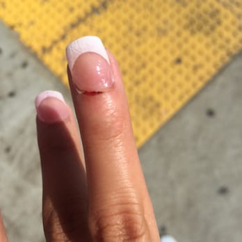 Victorian Nails - 1/2 he made me bleed while doing my nails and continued to charge me full price and blamed it on me for having sensitive skin. - Nail Salons Near Me - San Diego, California Victorian Nails - 1/2 he made me bleed while doing my nails and continued to charge me full price and blamed it on me for having sensitive skin. - Nail Salons Near Me - San Diego, California