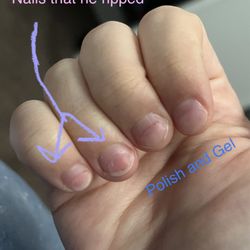 Top Nails - My botched nails