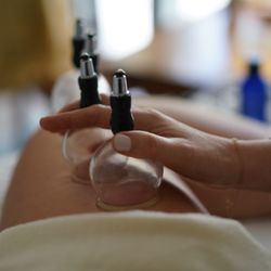 Heaven & Earth - Cupping. Safe and effective modality to treat muscular tightness, pain and dysfunction