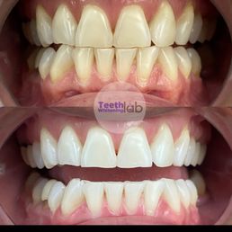 Before and after picture!