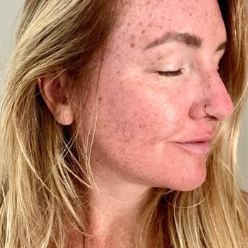 Heyday - Lowry - Clean beautiful skin by them. Freckles and sunburn by me. - Day Spas Near Me - Denver, Colorado