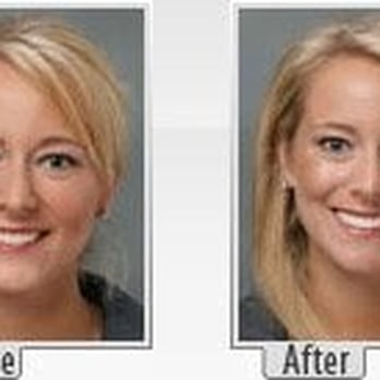 Southern California Endodontics - Smile Kitty Kat! - Endodontists Near Me - Anaheim, California Southern California Endodontics - Smile Kitty Kat! - Endodontists Near Me - Anaheim, California