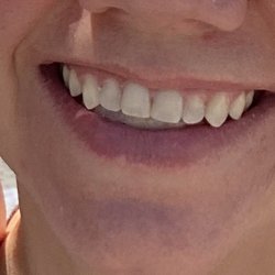 Nance Orthodontics