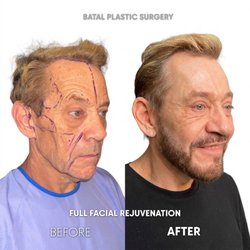 Batal Plastic Surgery