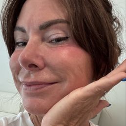 After the facial! After the facial!