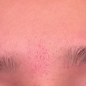 Grace Threading - The left is thinner and shorter than the right brow. Now I have to wait until it grows out and go to another salon. - Skin Care Near Me - San Diego, California Grace Threading - The left is thinner and shorter than the right brow. Now I have to wait until it grows out and go to another salon. - Skin Care Near Me - San Diego, California