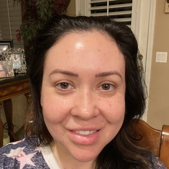 Total Health & Wellness - No makeup. I no longer have the signs on my forehead of a lifetime of being an overly expressive b****! Thank you David and Kim! - Medical Spas Near Me - Temecula, California Total Health & Wellness - No makeup. I no longer have the signs on my forehead of a lifetime of being an overly expressive b****! Thank you David and Kim! - Medical Spas Near Me - Temecula, California