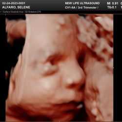 New Life Ultrasound