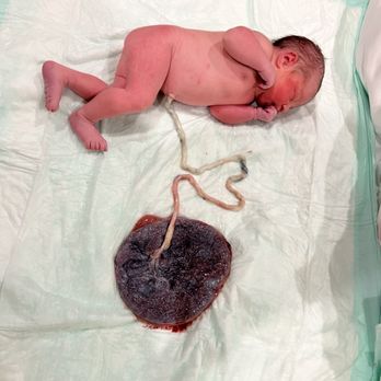 Pure Births - So amazing to see the placenta just minutes after birth. - Midwives Near Me - Santa Clarita, California