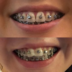Magic Smiles