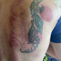 Lotus Massage - Perfect cupping' felt amazing! Thank you Mimi