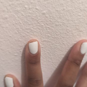 Acryliq Nails - More photos of the peeling. 2 days later after service - Nail Salons Near Me - Canoga Park, California