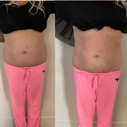 Just Peachy Body Shaping