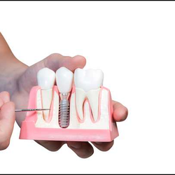 MyDentist La Puente