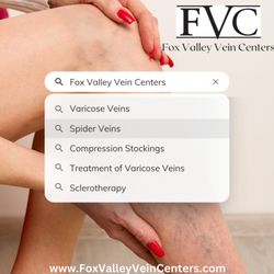 Fox Valley Vein Centers - We treat Varicose and Spider Veins