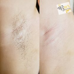 Bee's Wax Studio - Underarm wax! Before was 4 weeks of growth!