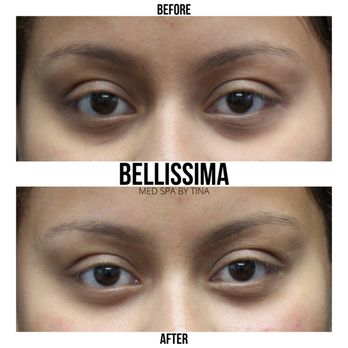 Bellissima Med Spa By Tina - .. - Medical Spas Near Me - Orange, California Bellissima Med Spa By Tina - .. - Medical Spas Near Me - Orange, California