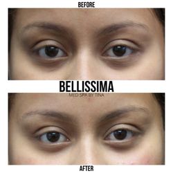 Bellissima Med Spa By Tina - ..