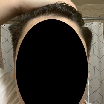 Xcellent Hair Square - Asymmetrical and disproportional sides of my hair. Top and front parts of left side sticking out looking like undone. - Hair Salons Near Me - Flushing, New York Xcellent Hair Square - Asymmetrical and disproportional sides of my hair. Top and front parts of left side sticking out looking like undone. - Hair Salons Near Me - Flushing, New York