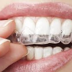 Premiere Dental Care Center - Elite Invisalign Provider