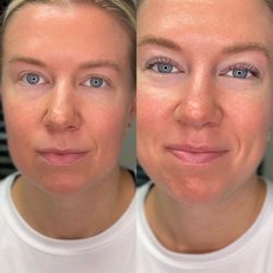 It's A Lash Thing - Lash Lift & Tint