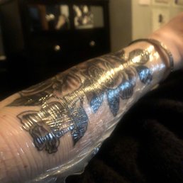 It's kind of hard to see because of the Saniderm, but I'm so happy with how it turned out It's kind of hard to see because of the Saniderm, but I'm so happy with how it turned out