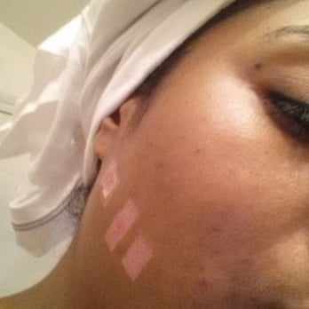 Body Beautiful - Burns - Medical Spas Near Me - Cranberry Twp, Pennsylvania Body Beautiful - Burns - Medical Spas Near Me - Cranberry Twp, Pennsylvania