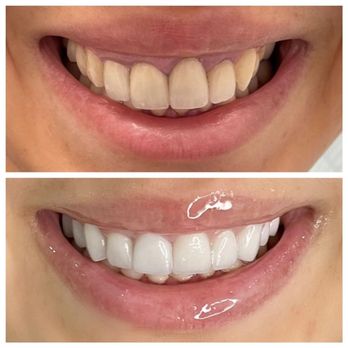 General and Cosmetic Dental - Before/After - General Dentistry Near Me - Brooklyn, New York General and Cosmetic Dental - Before/After - General Dentistry Near Me - Brooklyn, New York