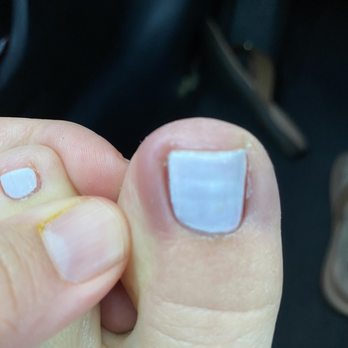 Cosmo Nail Bar - The lady cut me on the wrong side and my toe is all swollen and infected. - Nail Salons Near Me - Brea, California