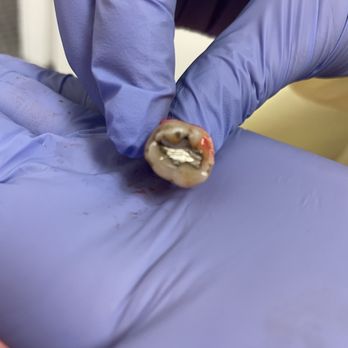 Sam F Khoury, DMD - Don't judge my disgusting tooth. They needed this eviction. - Oral Surgeons Near Me - Vacaville, California Sam F Khoury, DMD - Don't judge my disgusting tooth. They needed this eviction. - Oral Surgeons Near Me - Vacaville, California