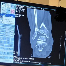 Tricounty Radiology - West Ashley - CT Scan of rear of right foot