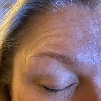 Arch 2 Arch - Scabs on eyelids - Skin Care Near Me - Memphis, Tennessee Arch 2 Arch - Scabs on eyelids - Skin Care Near Me - Memphis, Tennessee