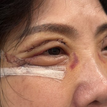 Lawton W Tang, MD - Cosmetic Surgeons Near Me - Pasadena, California Lawton W Tang, MD - Cosmetic Surgeons Near Me - Pasadena, California