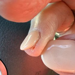 Purelux Nail Spa 2 - Cut on finger from filing